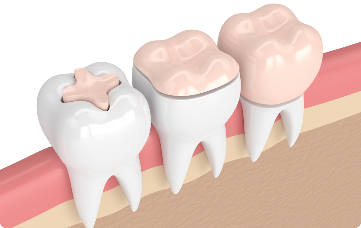 adobestock_423356739 (2)