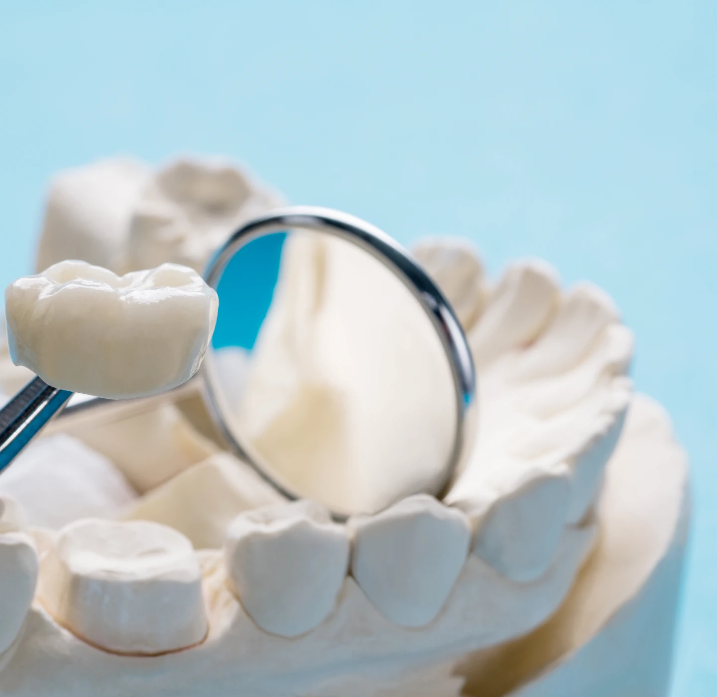 protheses-dentaires-traitements